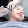 Image 2: 1, 2, or 3 Full Face & Neck Profound RF Microneedling + Rejuran Healer