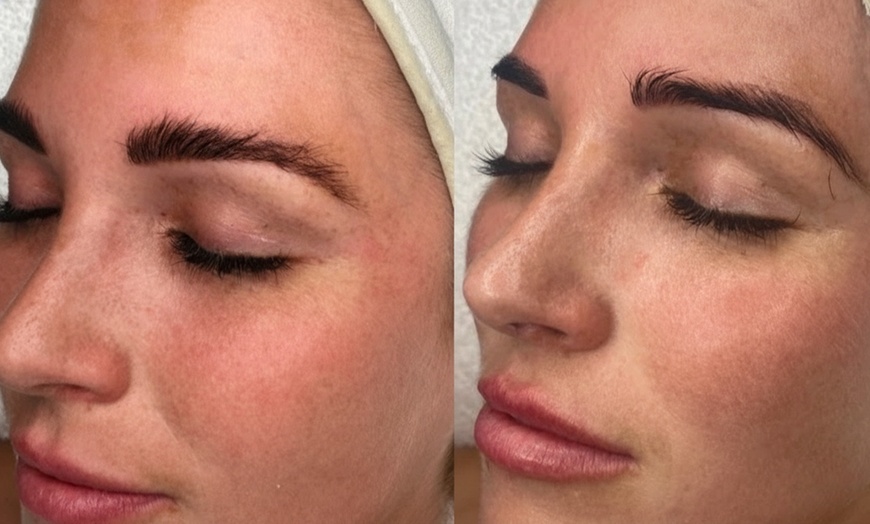 Image 6: Infusion Facial, Collagen Facial, Or Body Co Signature Facial