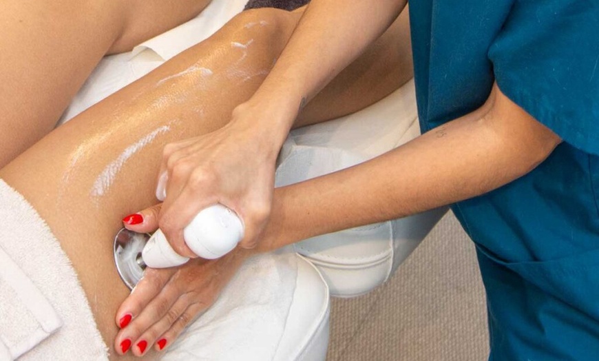 Image 4: 1 o 2 sesiones de 30 minutos de radiofrecuencia facial o corporal 