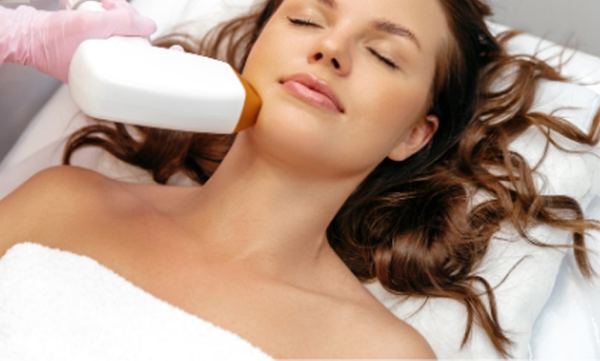 Image 2: 3 oder 5 Sessionen Laserhaarentfernung an einer kleinen / großen Zone