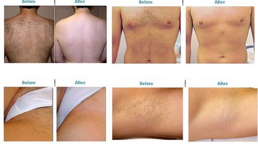 Image 3: Up to 37% Off on Brazilian / Bikini Waxing at W&M Beauty Center