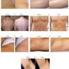 Image 3: Up to 37% Off on Brazilian / Bikini Waxing at W&M Beauty Center