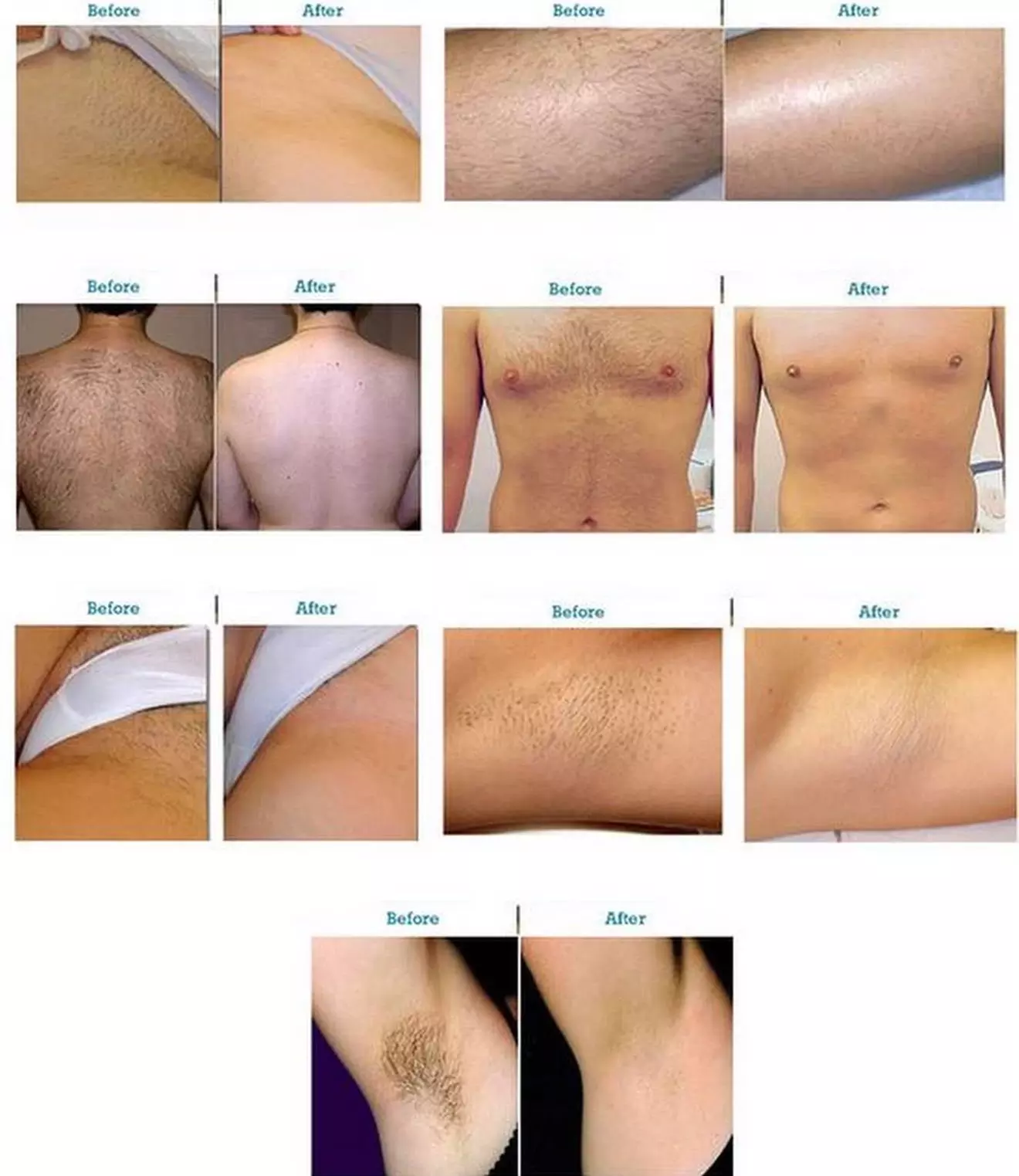 Up to 37% Off on Brazilian / Bikini Waxing at W&M Beauty Center