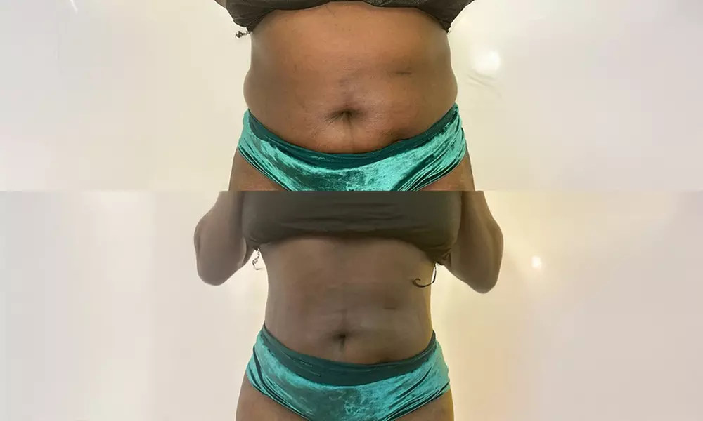 1 Infrared Detox Full Body Sauna Wrap or 3 Ionic Detox Foot Baths