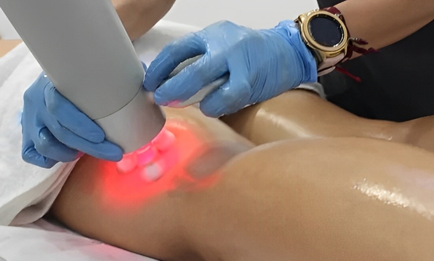 Image 8: 3 o 6 sesiones de combo reductor o remodelante con presoterapia y más