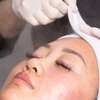 Image 2: Glycolic Peel or Facial Pamper Package at Carness Hill or Campbelltown