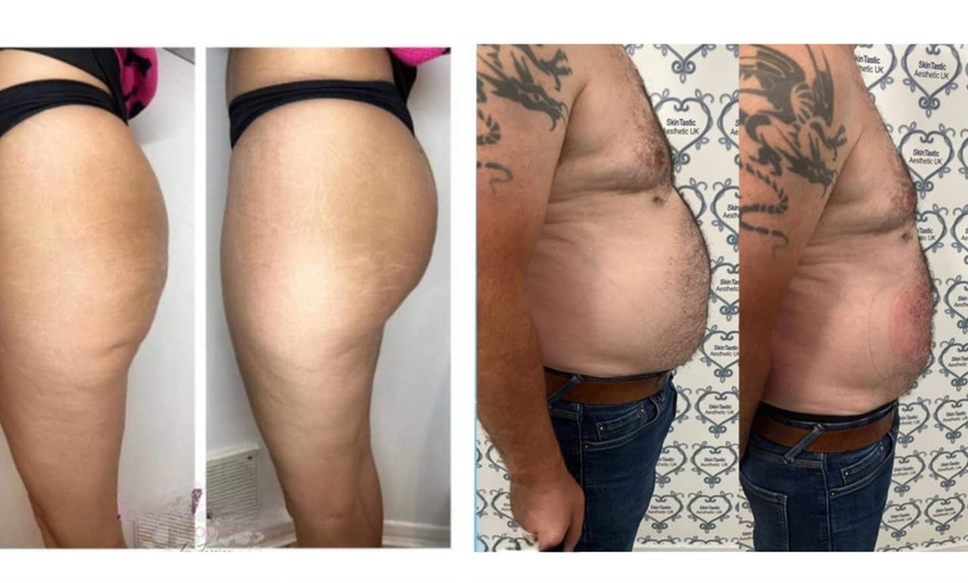 Image 3: Up to 83% Off EMS Body Sculpting - Tighten, Tone & Define 