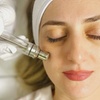 Image 1: Refresh Your Skin with One or Two Hydra Facials or VI Peels