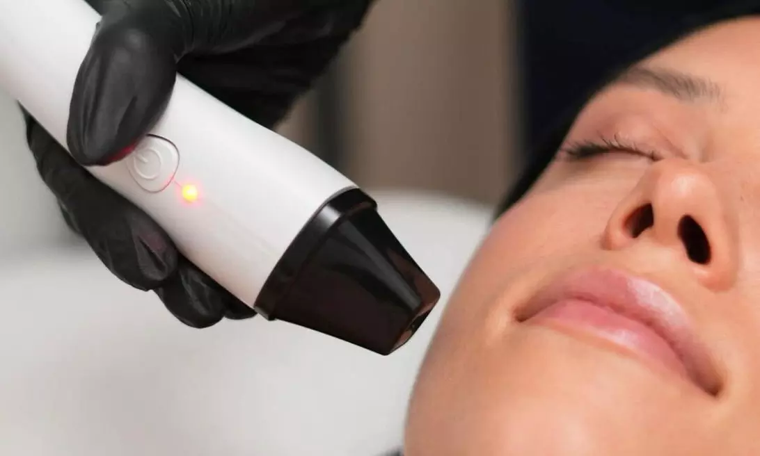 Kawitacja ultradźwiękowa, RF lifting i inne zabiegi dla jędrnej skóry