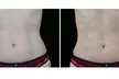 Get EMS Sculpt Abs/Buttocks/Thighs in Just 30 Minutes at Harmony In Health (Up to 74% Off) - Second Medium