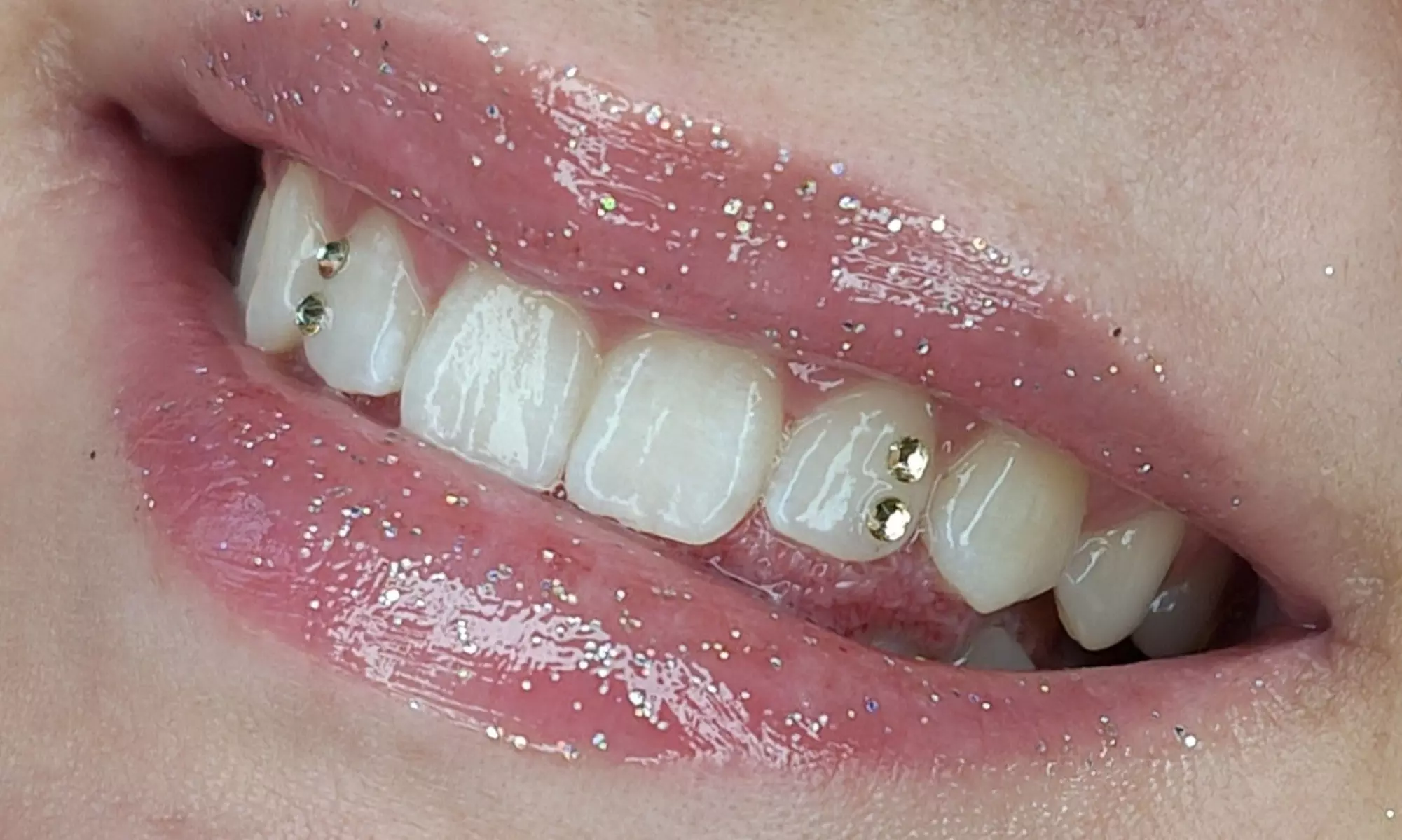 Biżuteria nazębna: kryształki w różnych wzorach i kolorach