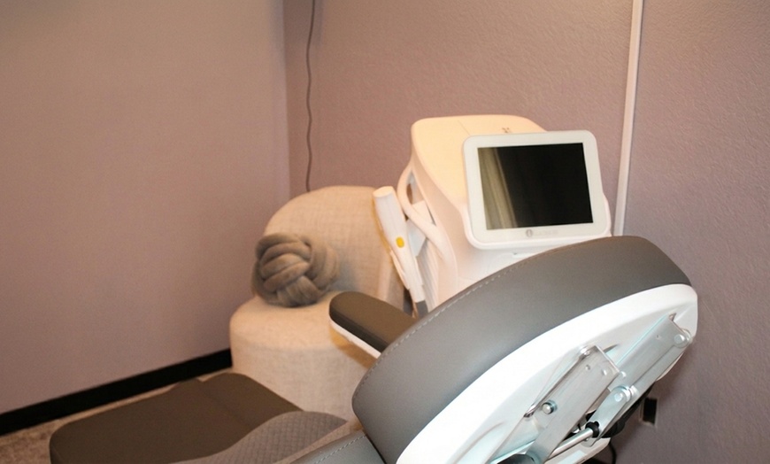 Image 3: 6 Splendor X Laser Hair Reduction Sessions for All Skin Types