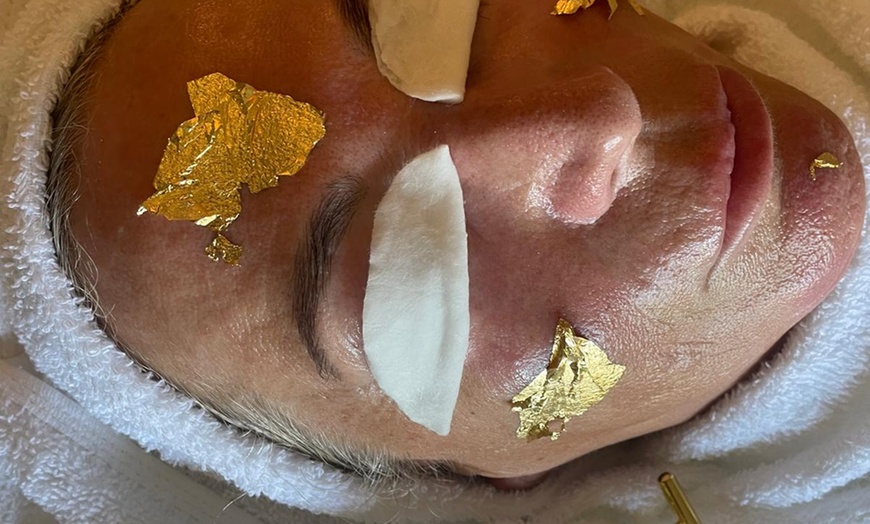 Image 2: Microneedling opt. mit Anti-Aging-24K-Treatment oder Aquafacial