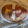 Image 2: Microneedling opt. mit Anti-Aging-24K-Treatment oder Aquafacial