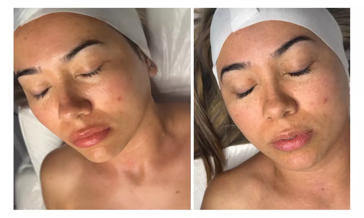 Face, Neck & Hand Massage with Aromatherapy + Optional Facial
