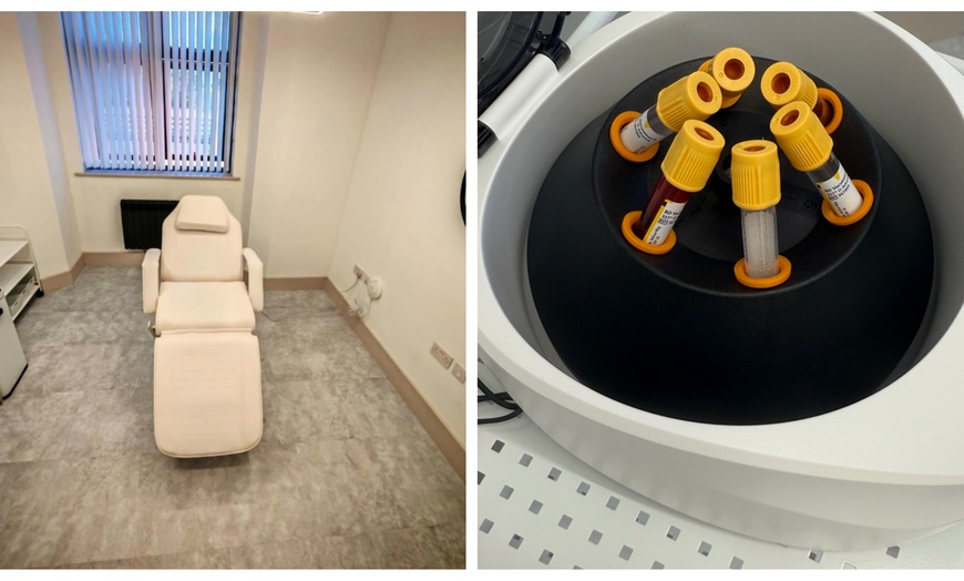 Image 2: Up to 50% Off on Vampire Facelift at The Aesthetic Clinic by Dr Sabbia