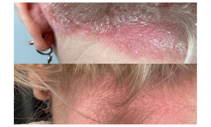 Image 4: Choose Medical Dermalux MD Triwave LED Light Therapy Pak of 10 or 20 