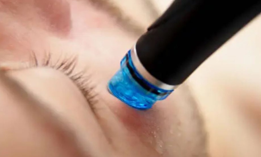 Image 6: Limpieza facial, Hydrafacial o Premium con kobido y máscara led/oro 