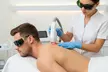 Get Smooth with 6 Laser Hair Removal Sessions on One Small, Medium, Large, or Extra Large Area (Up to 73% Off) - Second Medium