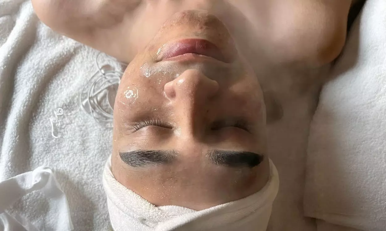 One, Two, Three, or Five 75-Min Microdermabrasion or Hydrodermabrasion