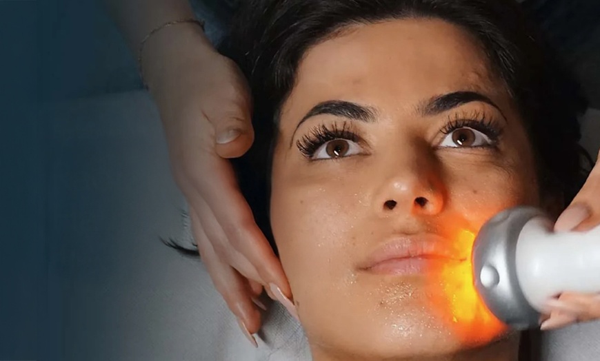 Image 1: 30 Min. Radiofrequenz Hautstaffung für das Gesicht für 1 Person