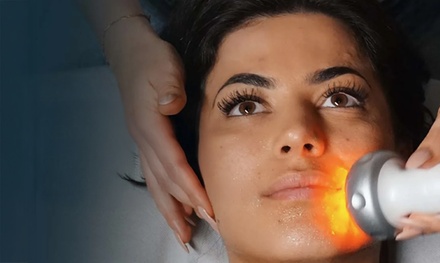 30 Min. Radiofrequenz Hautstaffung für das Gesicht für 1 Person - doctorfrost Kältekammer Frankfurt