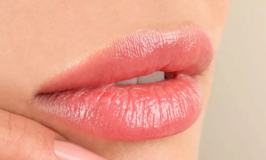 Image 1: 1 o 2 sesiones de re-hidratación de labios con Dermapen y vitaminas 