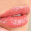 Image 1: 1 o 2 sesiones de re-hidratación de labios con Dermapen y vitaminas 