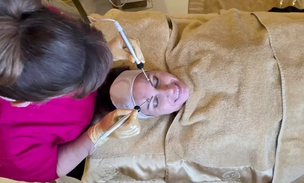 Revitalize your skin: 1x, 3x, or 5x RF Micro-Needling Facial (60-Min)