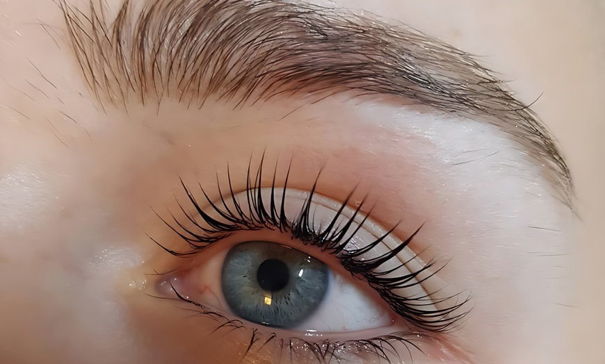 Image 3: Verzorg je huid intensief: gezichtsbehandeling of microneedling