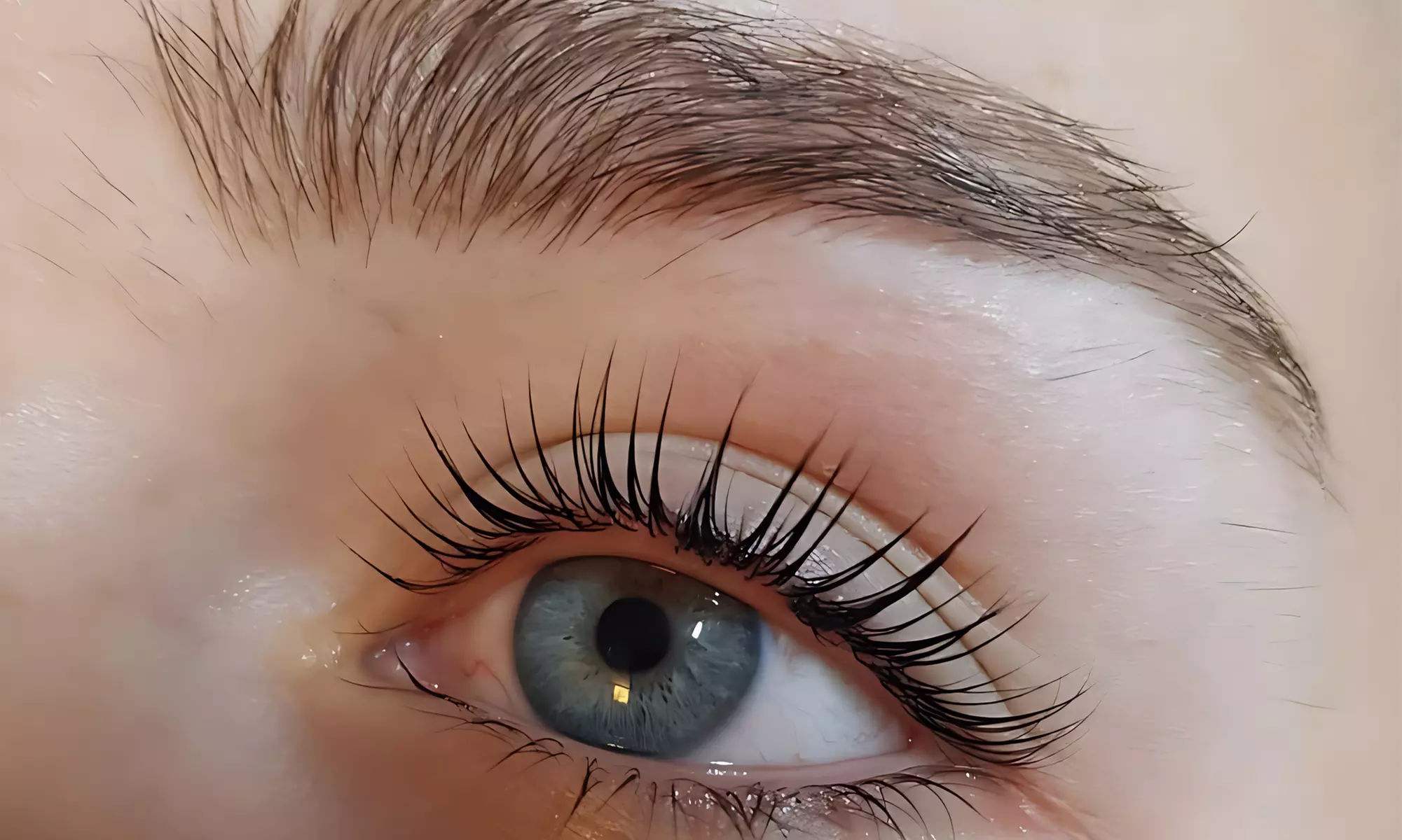 Verzorg je huid intensief: gezichtsbehandeling of microneedling