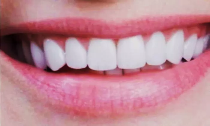 Experience Personalized Dental Care with Comprehensive Dental Exams