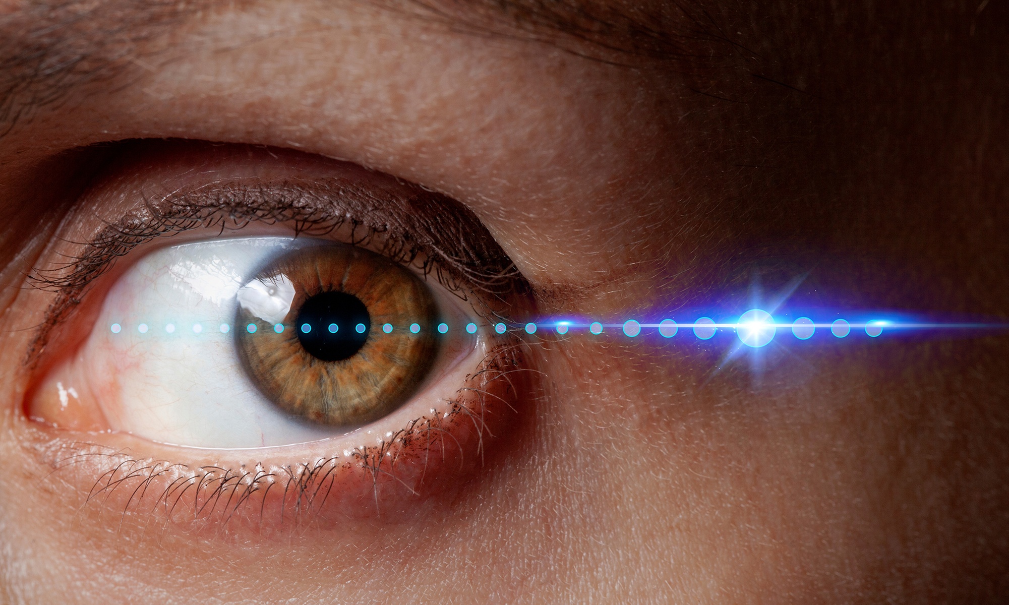 Formation en DTMA avec Meformer