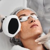 Image 1: Up to 70% Off on IPL Photo Facial at Botox and Filler Lab