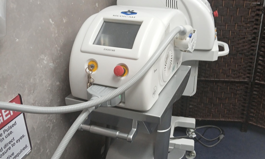 Image 3: Experience Smoothness with 6 Laser Hair Removal Sessions