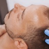 Image 8: PRP for Facial or Hair Restoration with 1, 2, or 4 Tubes