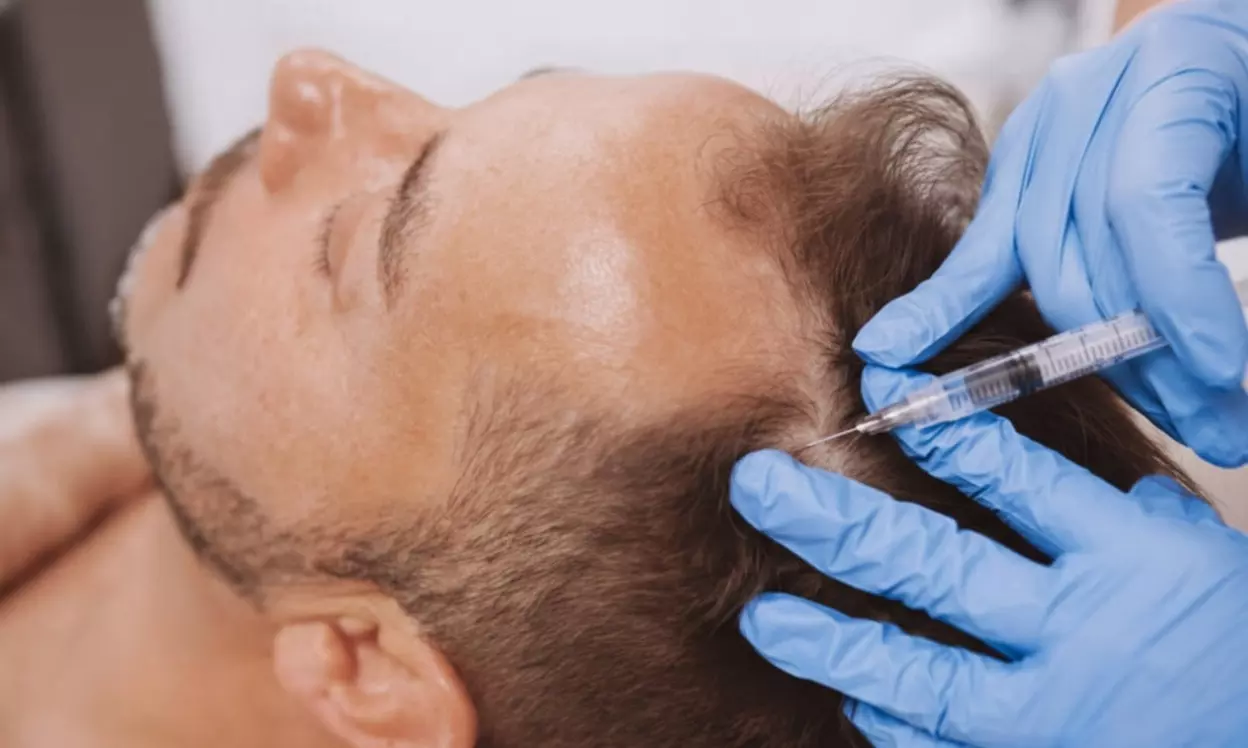 PRP for Facial or Hair Restoration with 1, 2, or 4 Tubes
