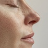 Image 5: Plump, Smooth & Glow: 0.5, 1 or 2 ml Dermal Filler with Consultation