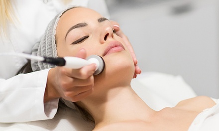 1 sesión de radiofrecuencia facial con diatermia - CARMIN