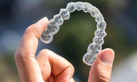 Achieve a Perfect Smile with Francis Dental's Clear Aligners! - Francis Dental
