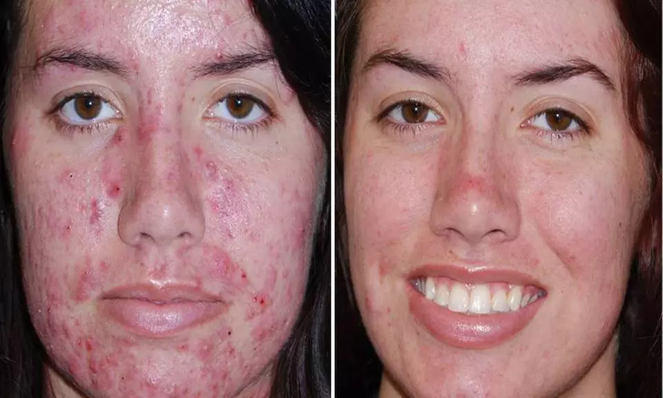 Glow & Sculpt: Body Wrap + Facial with  Optional LED Light Boost