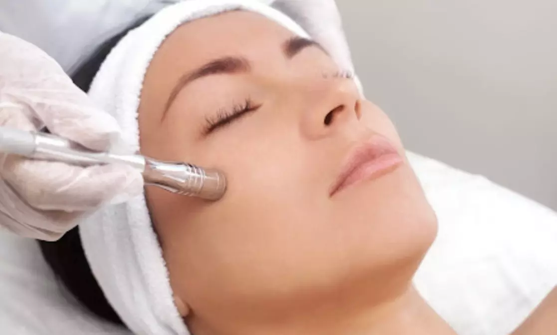 Tiefenreinigung mit verschiedenen Peelings oder Aqua-Facial-Gesichtsbehandlung für 1 Person (bis zu 46% sparen) - Second Medium