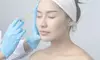 Get Smooth Skin with 20, 40, or 60 Units of Botox at RAE - an Aesthetic Experience (Up to 60% Off)