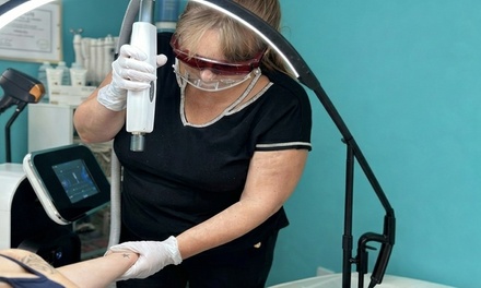 One Laser Tattoo Removal Treatment Session for Tattoo (Up to 7 Sq. Inches) - LLL STUDIO