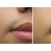 Image 5: 6 Sessions of Laser Hair Removal in Small, Medium, Large Areas & More