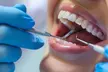 Up to 56% Off on  at AJ Dental Surgery - Image 2