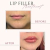 Image 2: Achieve a Refreshed Look with 20, 40, or 60 Units of Botox