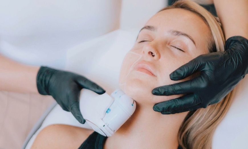 Image 2: HIFU 7D en rostro, cuello o papada con opción a radiofrecuencia para 1