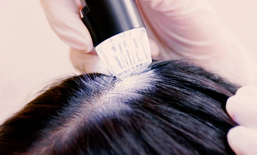 Image 3: Relaxing or Scalp Rescue Head Spa With Water Circulation & Massage