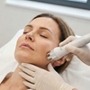 Image 3: One or Two Radio Frequency Skin Tightening Session for Face and Neck
